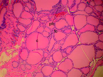 Figure 12 Thyroid histology with hematoxylin and eosin staining C colloid - photo 2