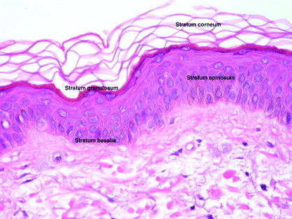 Fig 11 Overview of the epidermis demonstrating normal keratinocyte maturation - photo 1