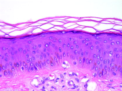 Fig 12 The stratum corneum demonstrates basket-weave orthokeratosis 400 - photo 2