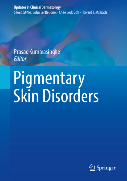 Prasad Kumarasinghe - Pigmentary Skin Disorders