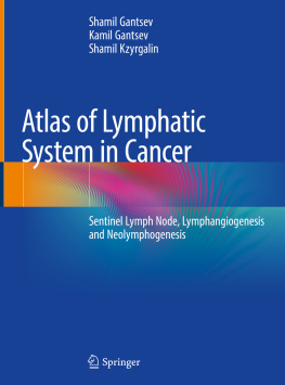 Shamil Gantsev Atlas of Lymphatic System in Cancer: Signal Lymph Node, Lymphangiogenesis and Neolymphogenesis