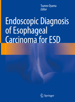 Tsuneo Oyama - Endoscopic Diagnosis of Esophageal Carcinoma for ESD