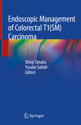 Shinji Tanaka - Endoscopic Management of Colorectal T1(SM) Carcinoma