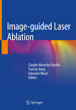 Claudio Maurizio Pacella - Image-guided Laser Ablation