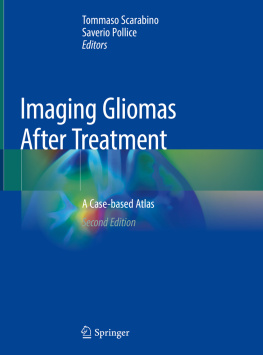 Tommaso Scarabino - Imaging Gliomas After Treatment: A Case-based Atlas