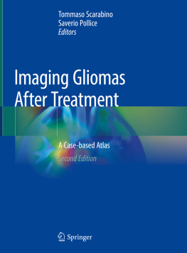 Tommaso Scarabino Imaging Gliomas After Treatment: A Case-based Atlas