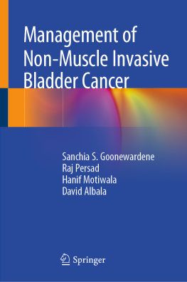 Sanchia S. Goonewardene Management of Non-Muscle Invasive Bladder Cancer