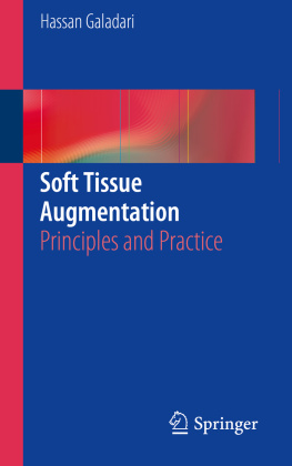 Hassan Galadari - Soft Tissue Augmentation: Principles and Practice