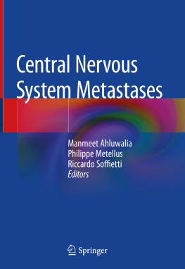 Manmeet Ahluwalia Central Nervous System Metastases