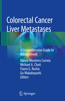 Mauro Monteiro Correia Colorectal Cancer Liver Metastases: A Comprehensive Guide to Management