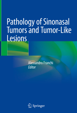 Alessandro Franchi Pathology of Sinonasal Tumors and Tumor-Like Lesions