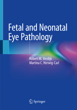 Robert M. Verdijk Fetal and Neonatal Eye Pathology