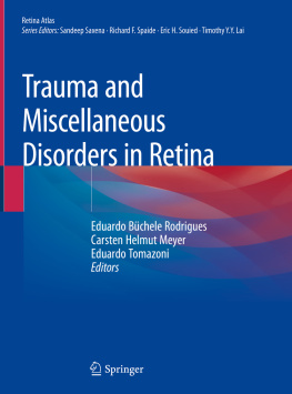 Eduardo Büchele Rodrigues Trauma and Miscellaneous Disorders in Retina