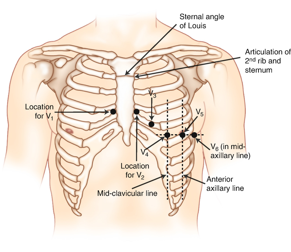 Fig 11 Landmarks for placement of precordial leads When recorded in the - photo 3