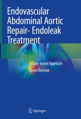 Stevo Duvnjak - Endovascular Abdominal Aortic Repair- Endoleak Treatment: A Case-based Approach