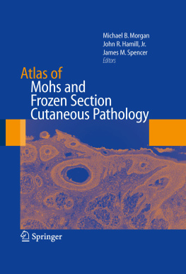 Michael Morgan (editor) - Atlas of Mohs and Frozen Section Cutaneous Pathology