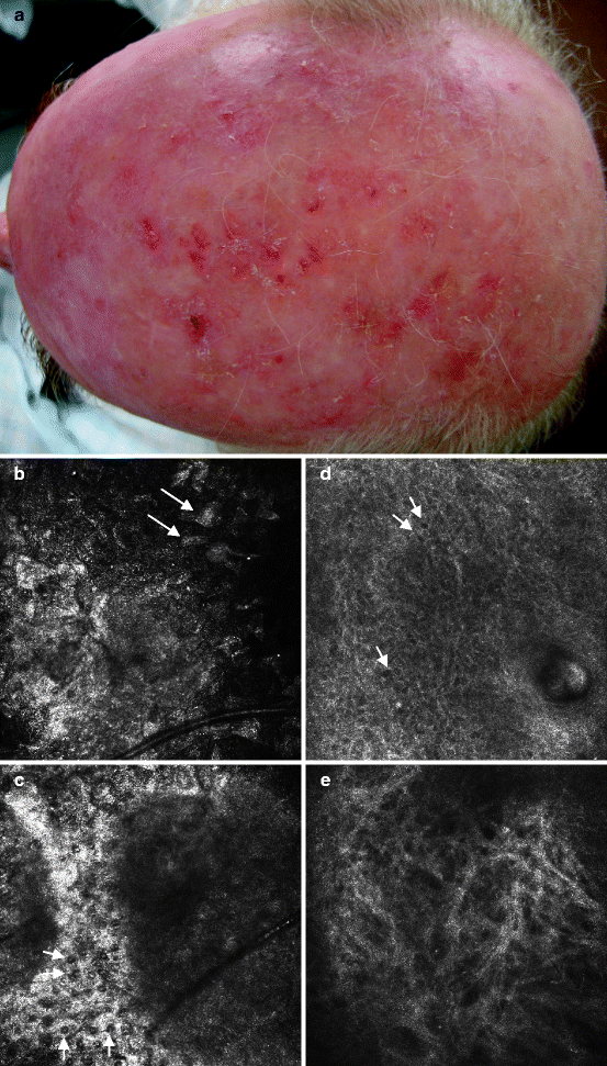 Fig 11 a Corresponds to clinical image of 67-year-old male with a long - photo 1