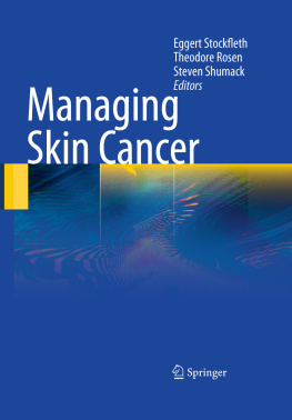 Eggert Stockfleth (editor) - Managing Skin Cancer