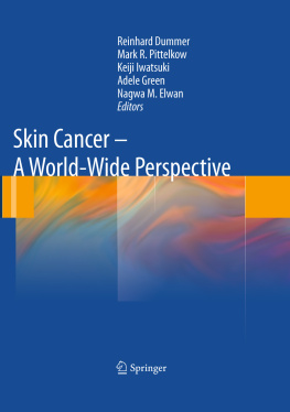 Reinhard Dummer (editor) Skin Cancer - A World-Wide Perspective