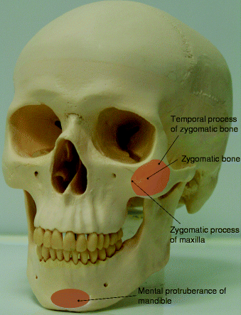 Fig 12 Convexities of the facial skeleton The mandible forms the lower - photo 2