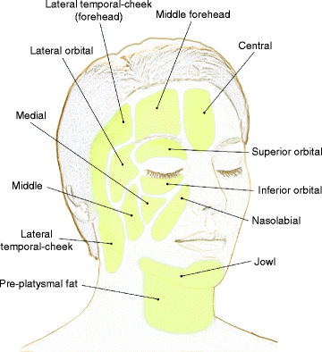 Fig 14 The superficial fat compartments of the face Fig 15 Ligaments - photo 4