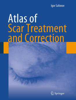 Igor Safonov - Atlas of Scar Treatment and Correction