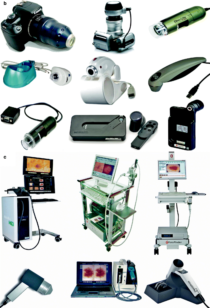 Fig 13 Examples of equipment that may be used to perform trichoscopy - photo 4