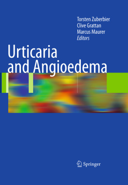 Torsten Zuberbier (editor) Urticaria and Angioedema