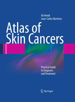 Ali Hendi - Atlas of Skin Cancers: Practical Guide to Diagnosis and Treatment