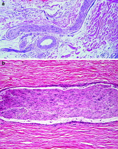 Fig 12 Peripheral nerve fascicle longitudinal sections of nerve fascicles in - photo 2