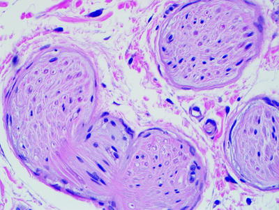 Fig 13 Peripheral nerve fascicles in cross section highlight the dot-like - photo 3