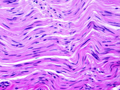 Fig 14 Schwann cells have slender elongated nuclei with one tapered and one - photo 4