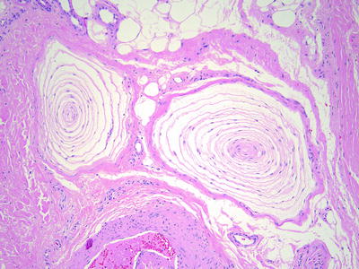 Fig 16 Pacinian corpuscles are composed of a central nerve fiber surrounded - photo 6