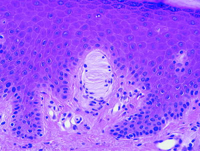 Fig 17 Meissner corpuscles are touch receptors located in the dermal papillae - photo 7