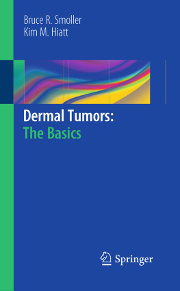 Bruce R. Smoller Dermal Tumors: The Basics