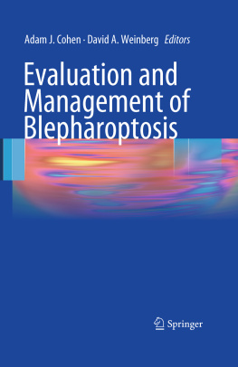 Adam J. Cohen Evaluation and Management of Blepharoptosis