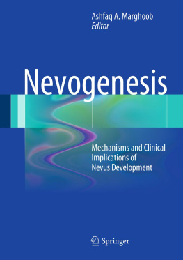 Ashfaq A. Marghoob (editor) Nevogenesis ; Mechanisms and Clinical Implications of Nevus Development