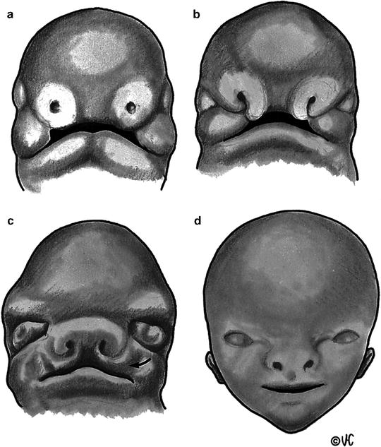 Fig 13 Facial development a Frontonasal and mandibular processes - photo 3