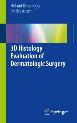 Helmut Breuninger - 3D Histology Evaluation of Dermatologic Surgery