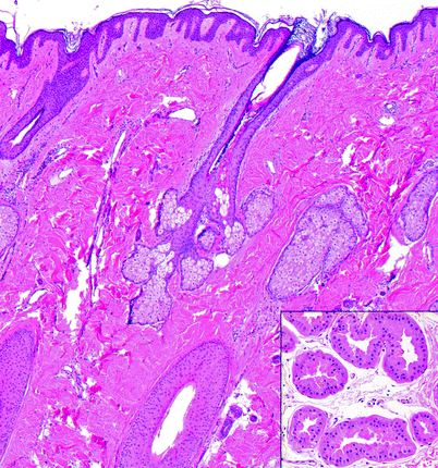 Fig 22 Pilosebaceous Apocrine Unit The sebaceous glands are associated with - photo 3