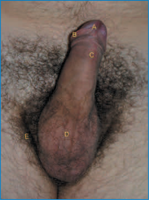 Fig 12 Ventral appearance of male genitalia A Frenulum B Foreskin C Penile - photo 2