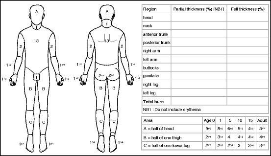 Fig 11 Lund and Browder chart for calculating TBSA burn Assessment of - photo 1