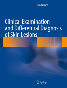 Dan Lipsker Clinical Examination and Differential Diagnosis of Skin Lesions