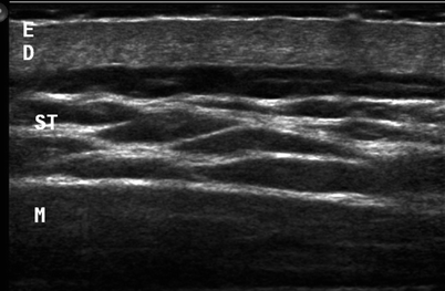 Fig 13 HVFUS image of skin layers and deeper structures Adjustments of focus - photo 3