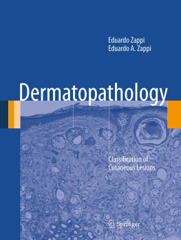 Eduardo Zappi - Dermatopathology: Classification of Cutaneous Lesions