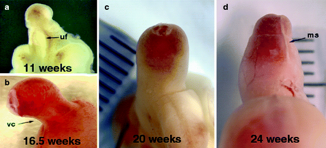 Fig 15 Male human fetal external genitalia during gestation a 11 weeks - photo 5