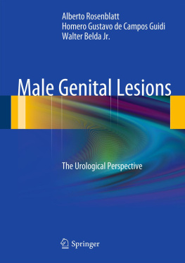 Alberto Rosenblatt - Male Genital Lesions: The Urological Perspective