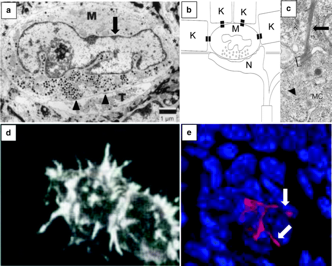 Fig 11 Merkel cell structure a Electron microscopic image of a Merkel - photo 1