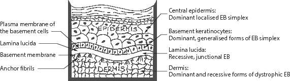 Fig 11 Site of the blistering of EB Waldhr In each of these main - photo 1