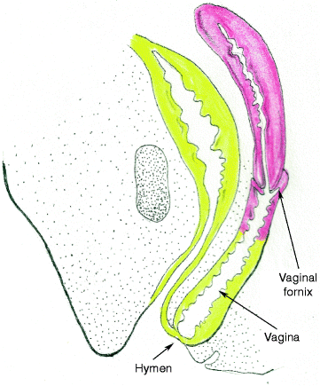 Fig 14 The fully canalized vagina in the newborn female More proximally - photo 4